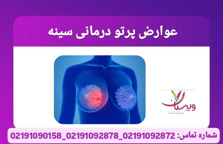 عوارض پرتو درمانی سینه