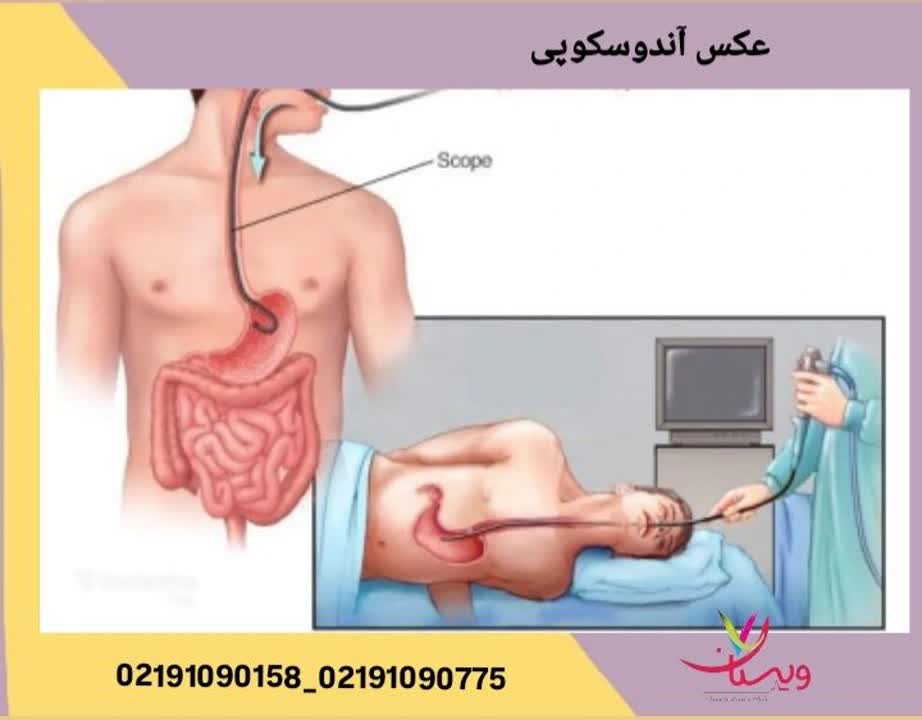 نمای داخلی اندام مورد بررسی در طی انجام آندوسکوپی تشخیصی عکس آندوسکوپی