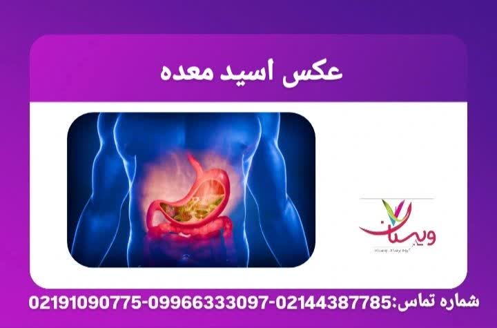 نمایش تصویری از معده و عملکرد غدد ترشحی آن در شرایط طبیعی و حالت اسیدی بالا، جهت آشنایی کاربران با ساختار معده. عکس اسید معده