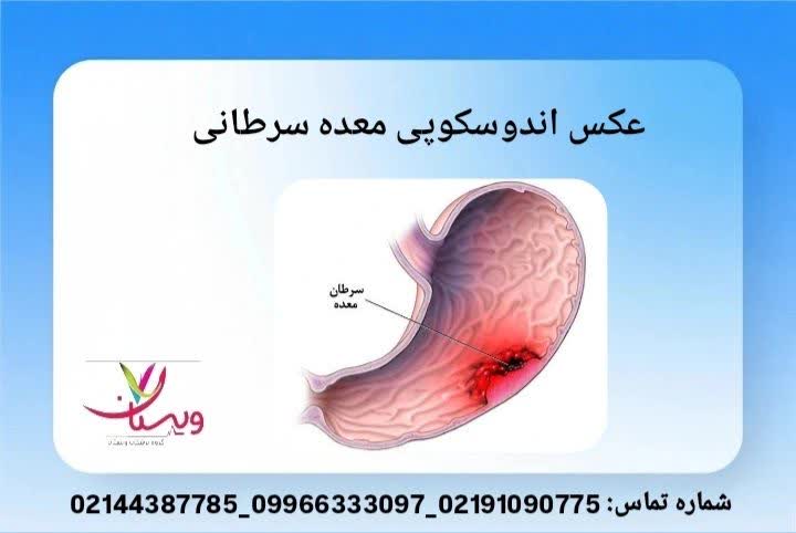 رنگ قرمز تیره و سطح ناهموار بیشتر نشانهی تغییرات سلولی پیشسرطانی یا سرطانی است زخمهای عمیق و لبههای نامنظم معده