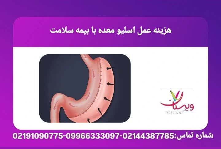 بررسی شرایط خاص پوشش عمل اسلیو معده در طرح بیمه سلامت و مراکز طرف قرارداد حمایت بیمه دانا از جراحی چاقی