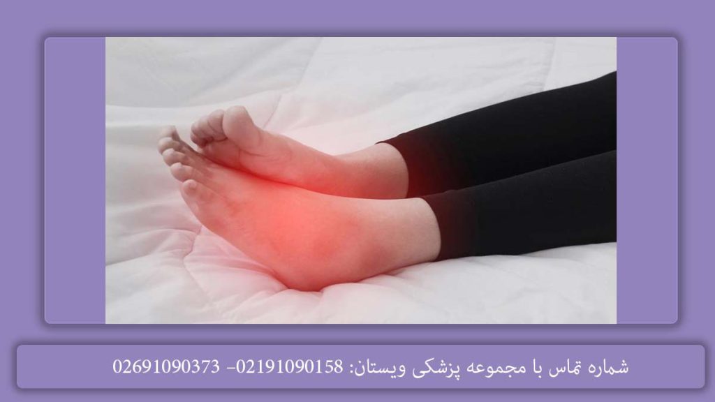 ورم روی پا از چیست بدانید: علت ورم پاها چیست