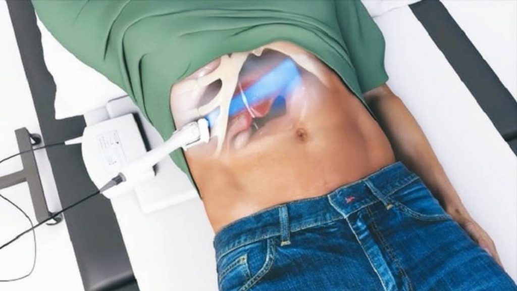 تحلیل جواب فیبرو اسکن کبد آزمایش خواندن جواب فیبرو اسکن کبد
