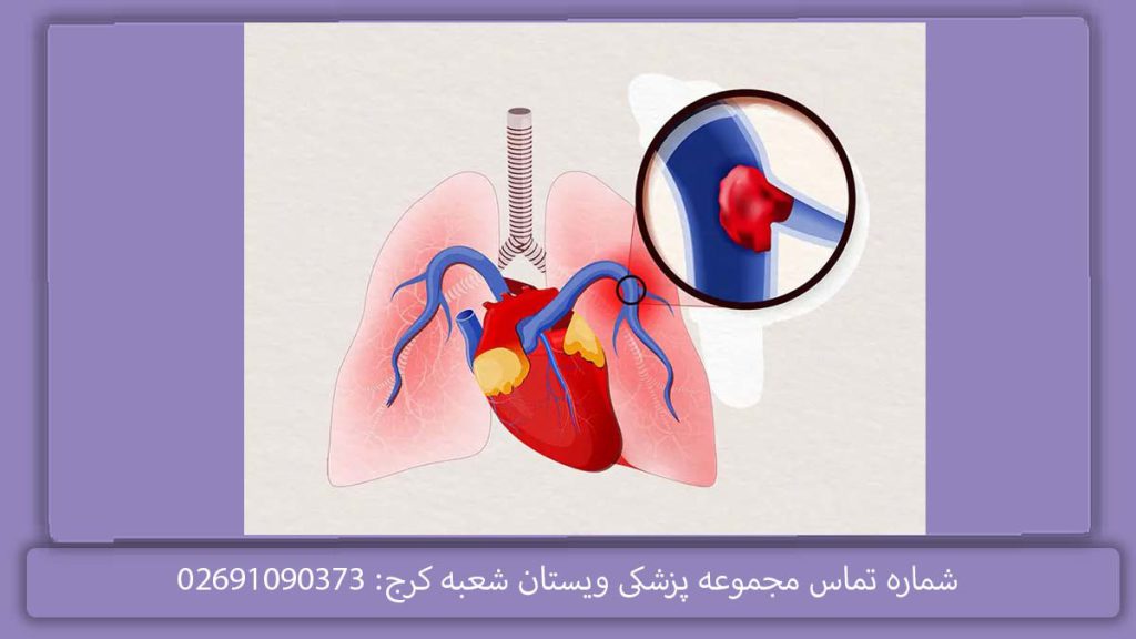 دکتر باصری فردیس بهترین متخصص قلب فردیس کرج