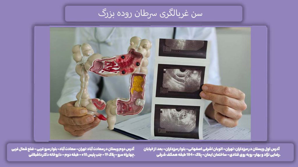سن آزمایش سرطان سن غربالگری سرطان روده بزرگ