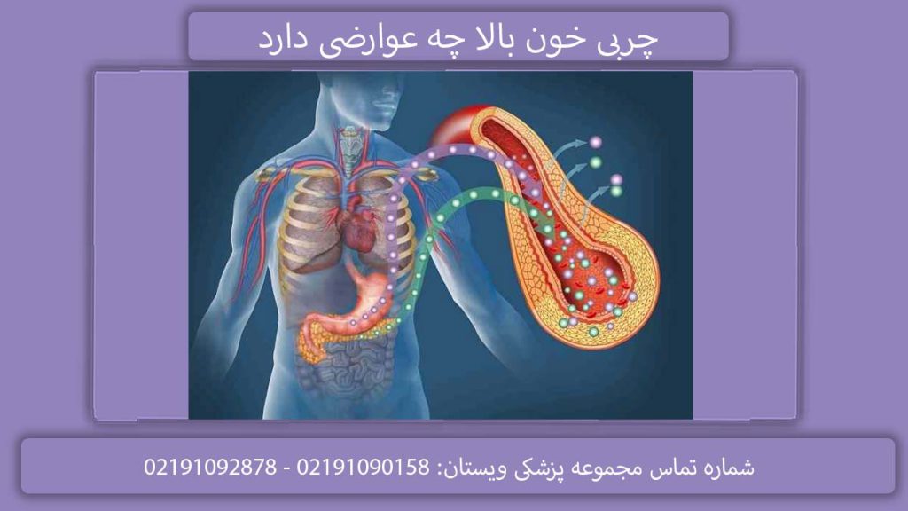 عوارض چربی خون بالا عوارض چربی خون بالا