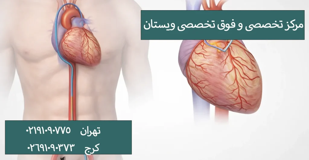 آیا قبل از سیتی آنژیو قلب نیاز به تزریق دارو یا ماده حاجب است؟