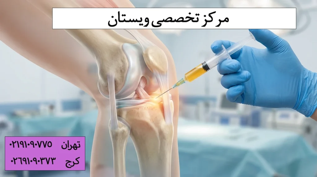 مراحل انجام پی آر پی زانو (گامبهگام و از زبان پزشک)