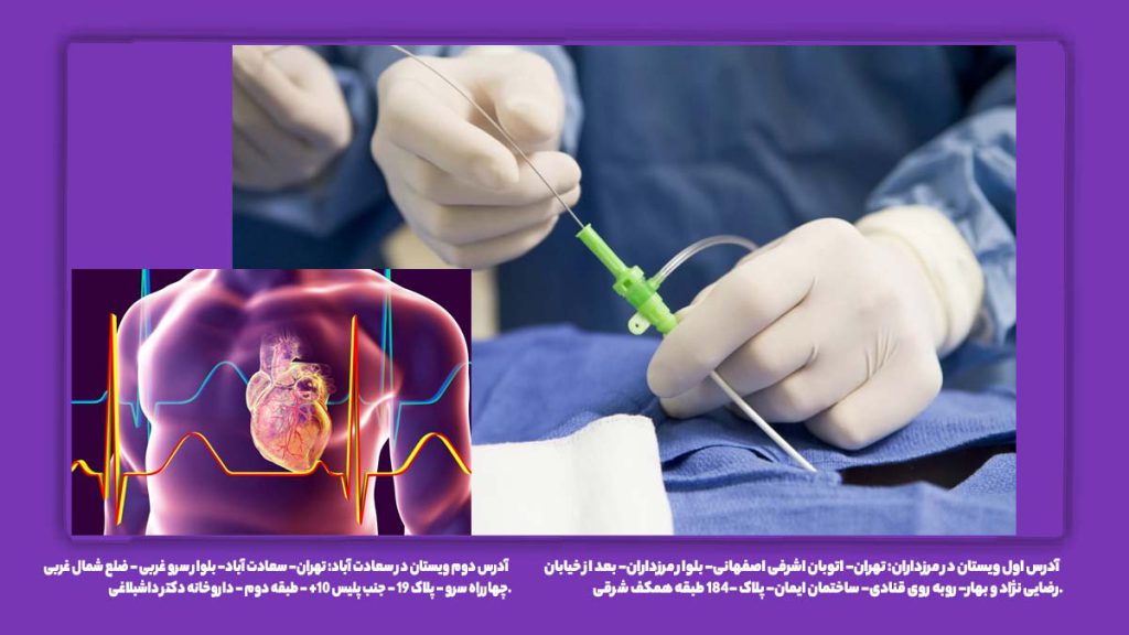 آندوسکوپی قلب و آنژیو آیا آندوسکوپی قلب همان آنژیوگرافی است