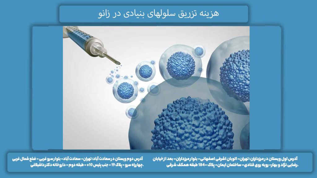 قیمت سلول بنیادی هزینه تزریق سلولهای بنیادی در زانو