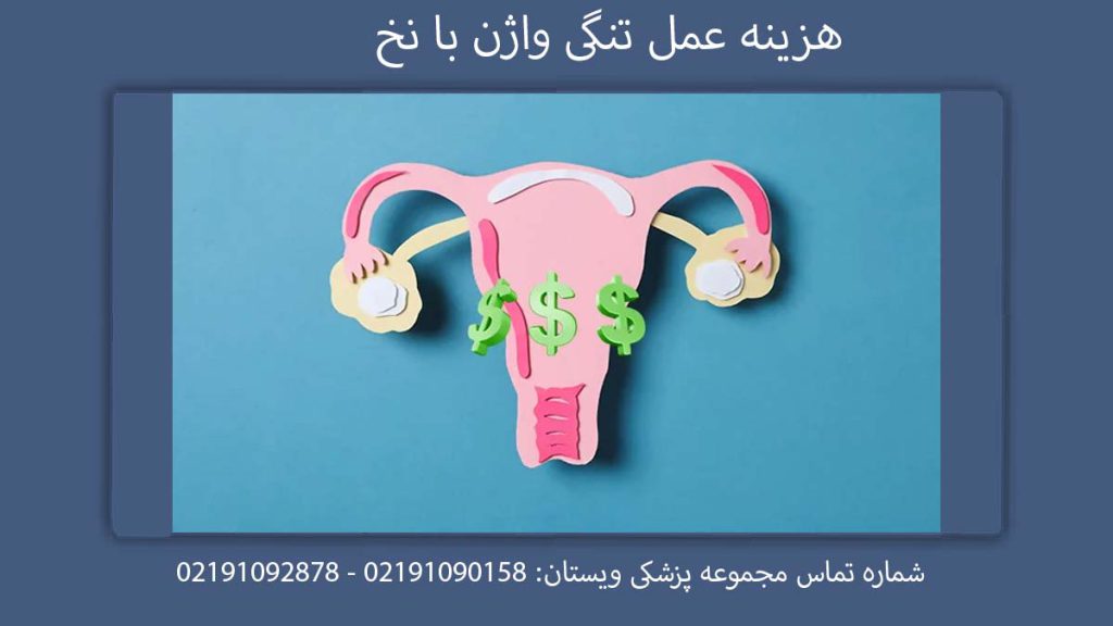 هزینه عمل تنگی واژن با نخ هزینه عمل تنگی واژن در تهران چقدر است؟