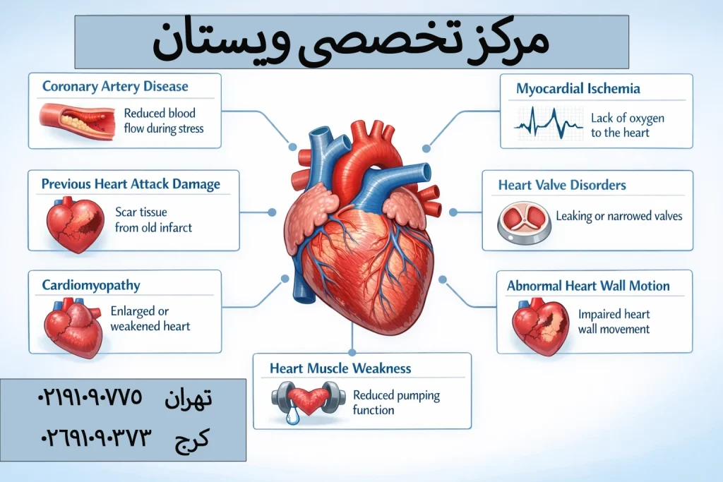 تفسیر نتیجه تست اکو استرس قلب به زبان ساده