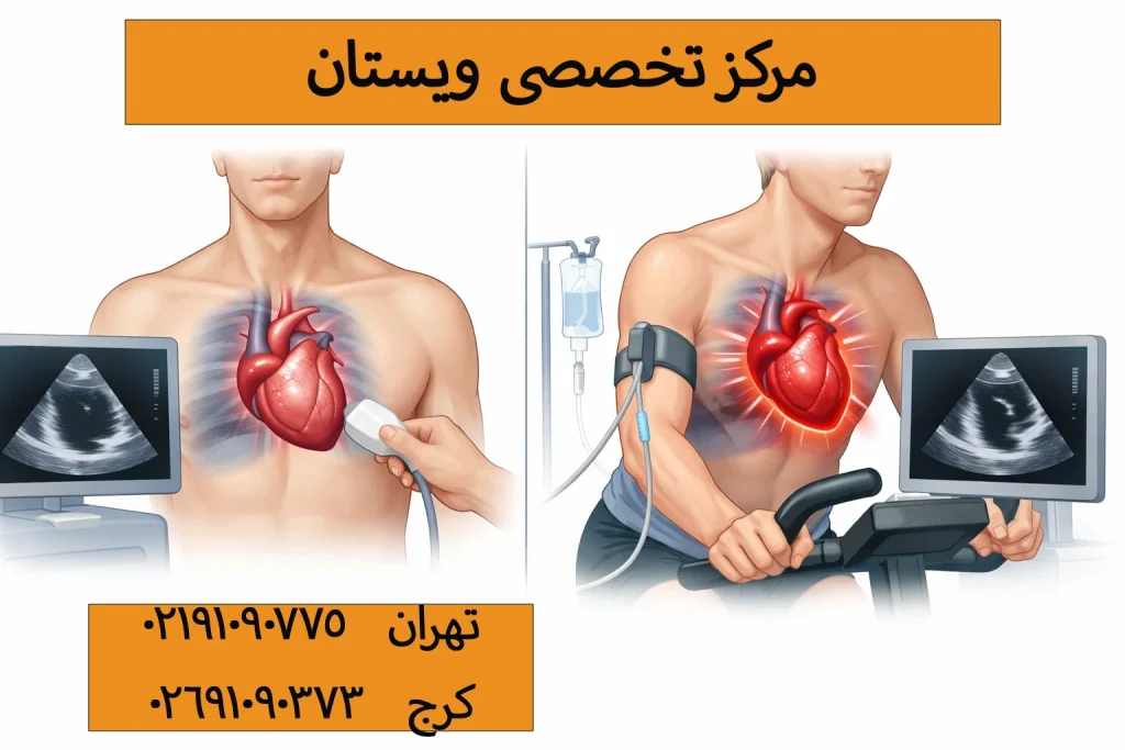 ۲. اکو استرس قلب؛ چه زمانی انجام میشود و نتیجه آن چه چیزی را نشان میدهد؟
