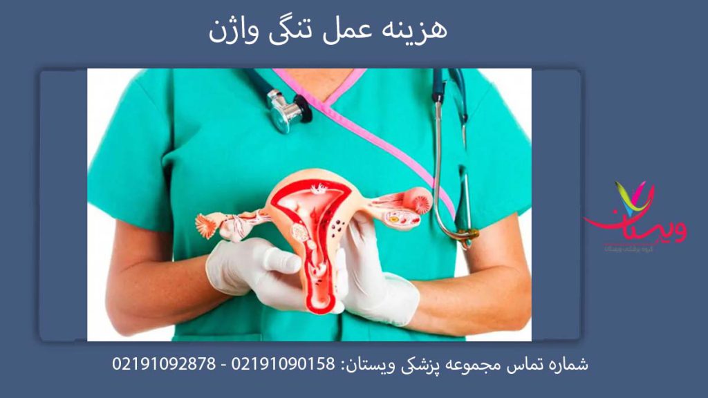 هزینه عمل تنگی واژن ۱۴۰۴ هزینه عمل تنگی واژن در تهران سال 1404