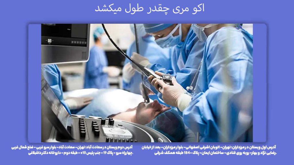آماده شدن جواب اکو جواب اکو مری چقدر طول میکشد