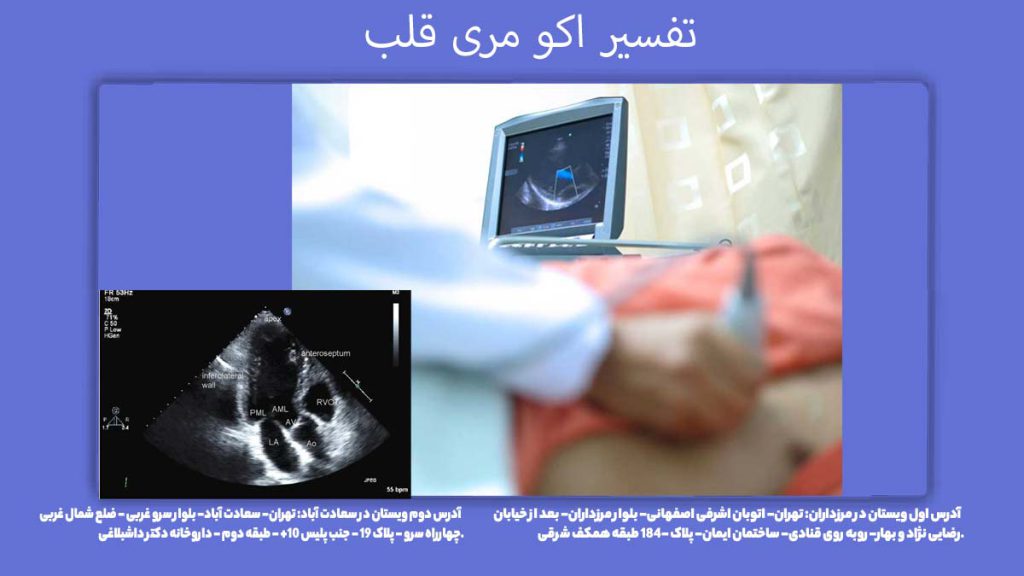 تفسیر و اصطلاحات سونو مری قلب تفسیر اکو مری قلب