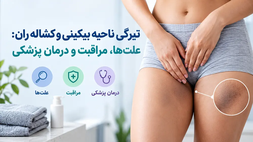 تیرگی ناحیه بیکینی و کشاله ران