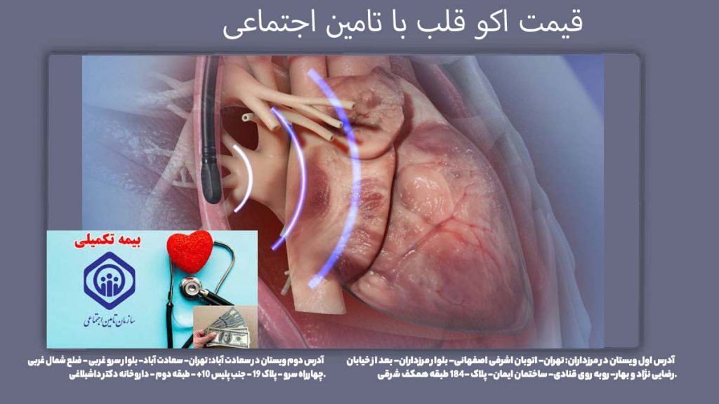 تعرفه اکو با بیمه تامین اجتماعی قیمت اکو قلب با دفترچه تامین اجتماعی