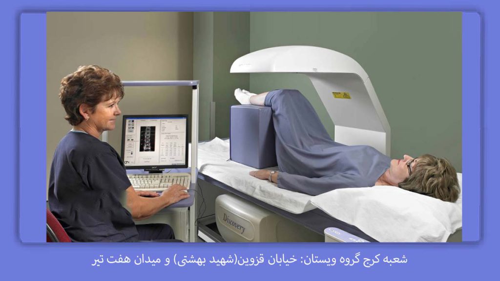 مراکز سنجش تراکم استخوان در کرج دکتر تراکم استخوان کرج در بهترین مراکز