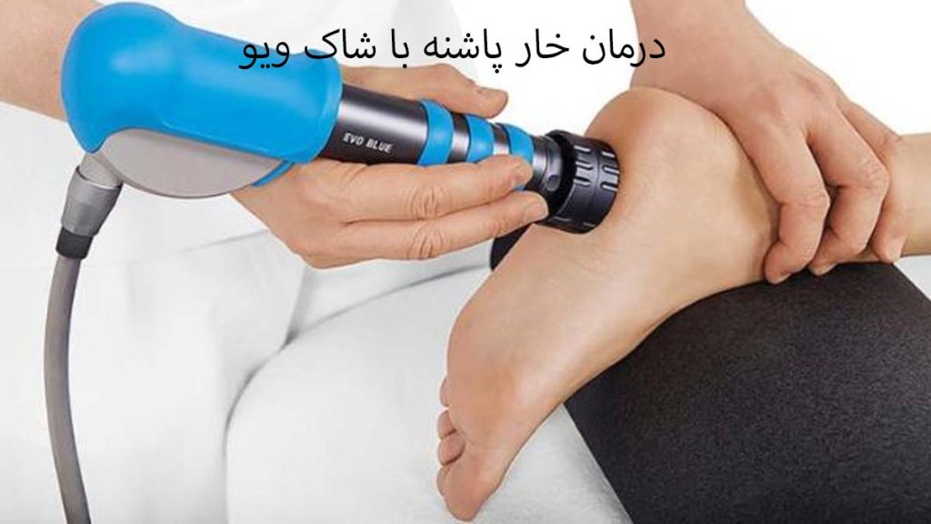 درمان خار پاشنه با شاک ویو