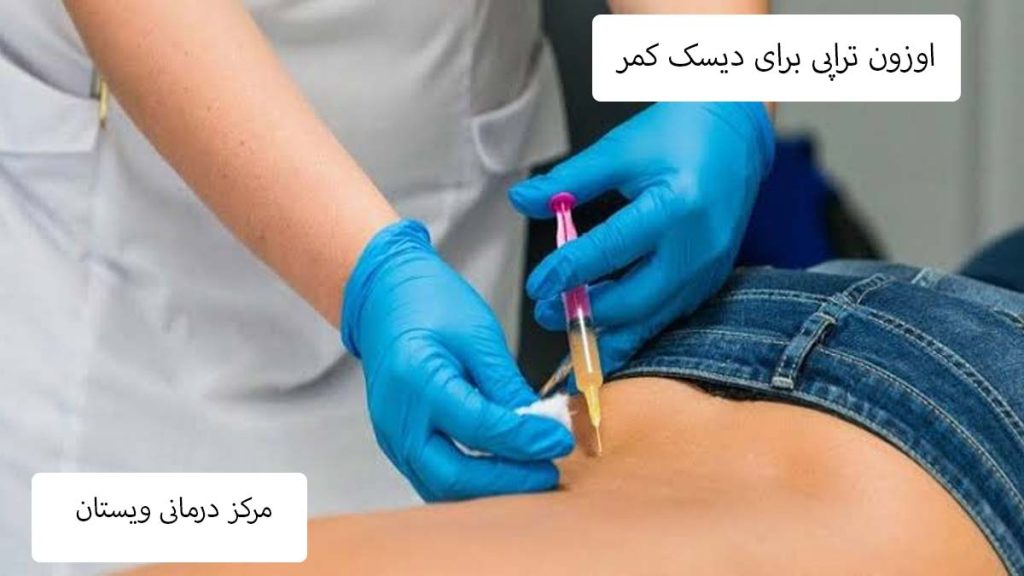 اوزون تراپی برای دیسک کمر