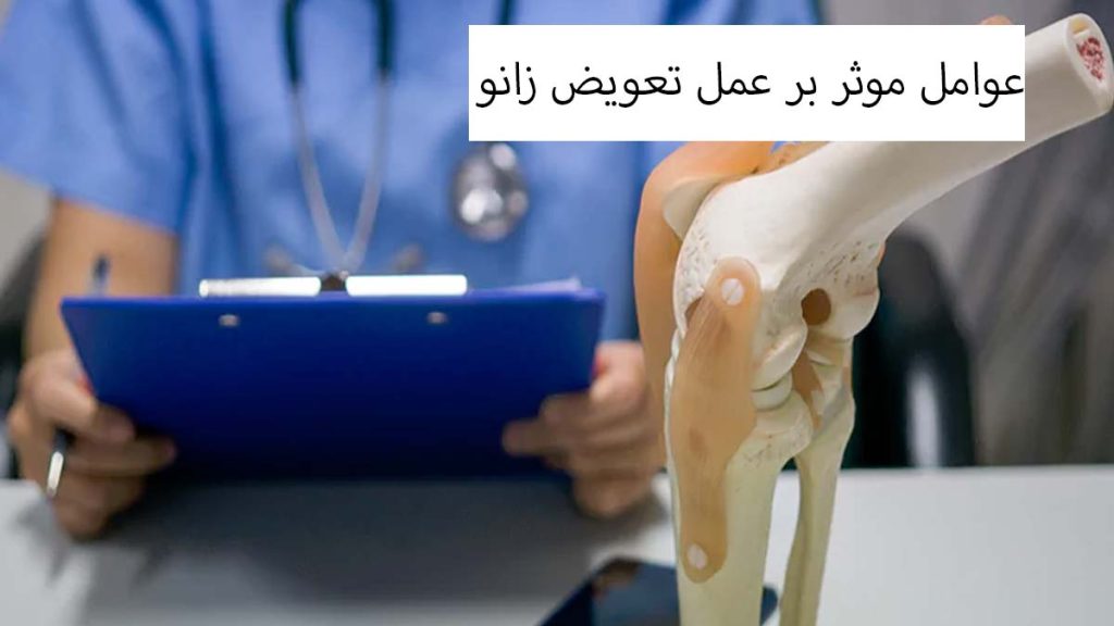 چه چیزی بر هزینه موثر است؟ عوامل موثر بر عمل تعویض زانو