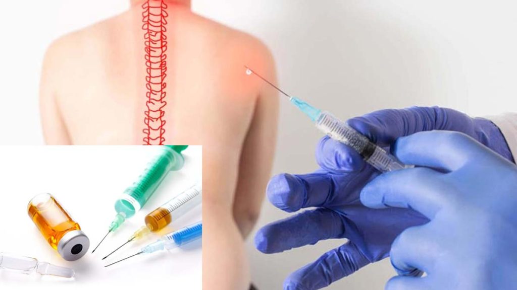 تعرفه تزریق ازون داخل دیسک هزینه اوزون تراپی دیسک کمر