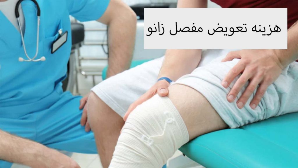 هزینه تعویض مفصل زانو