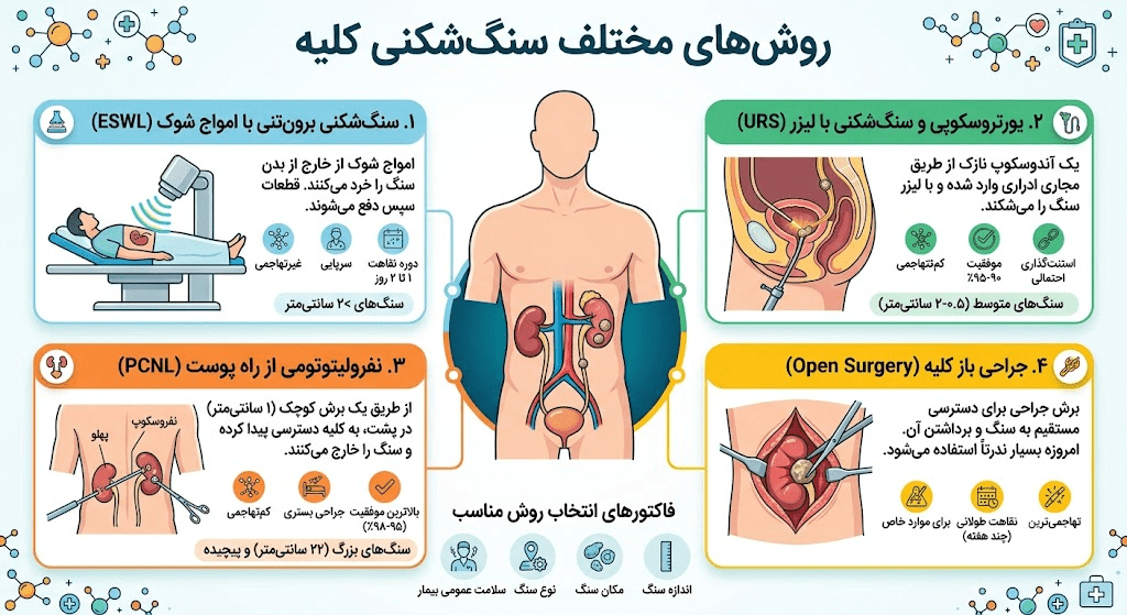 روشهای مختلف سنگشکنی کلیه انواع روش سنگشکنی کلیه