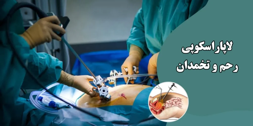 هزینه لاپاراسکوپی رحم و تخمدان