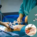 هزینه لاپاراسکوپی رحم و تخمدان