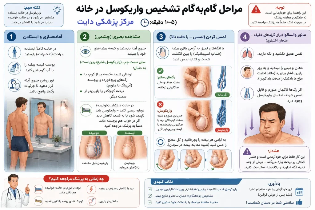تشخیص واریکوسل در خانه