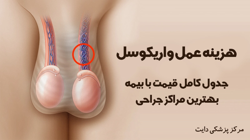 هزینه عمل واریکوسل 1405