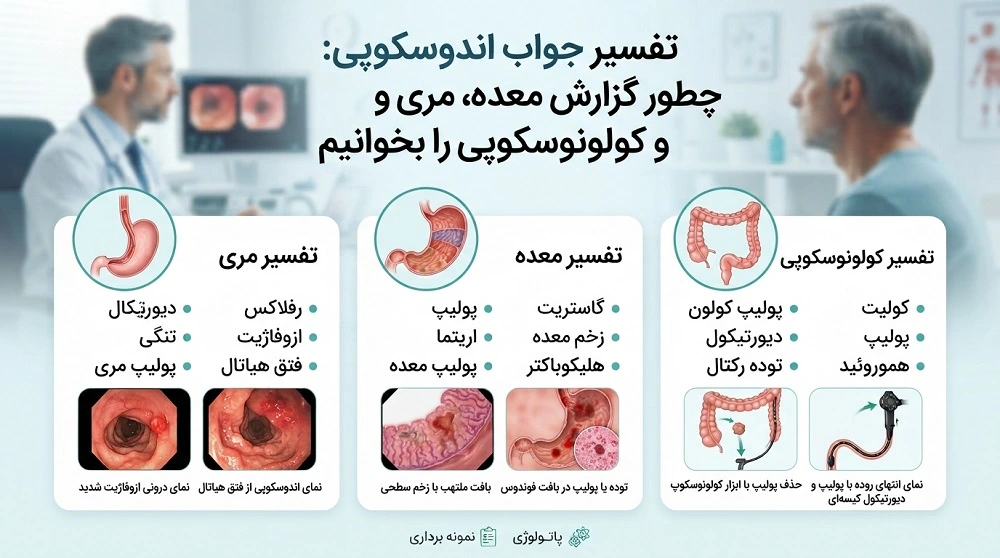 تفسیر جواب اندوسکوپی چطور گزارش معده، مری و کولونوسکوپی را بخوانیم